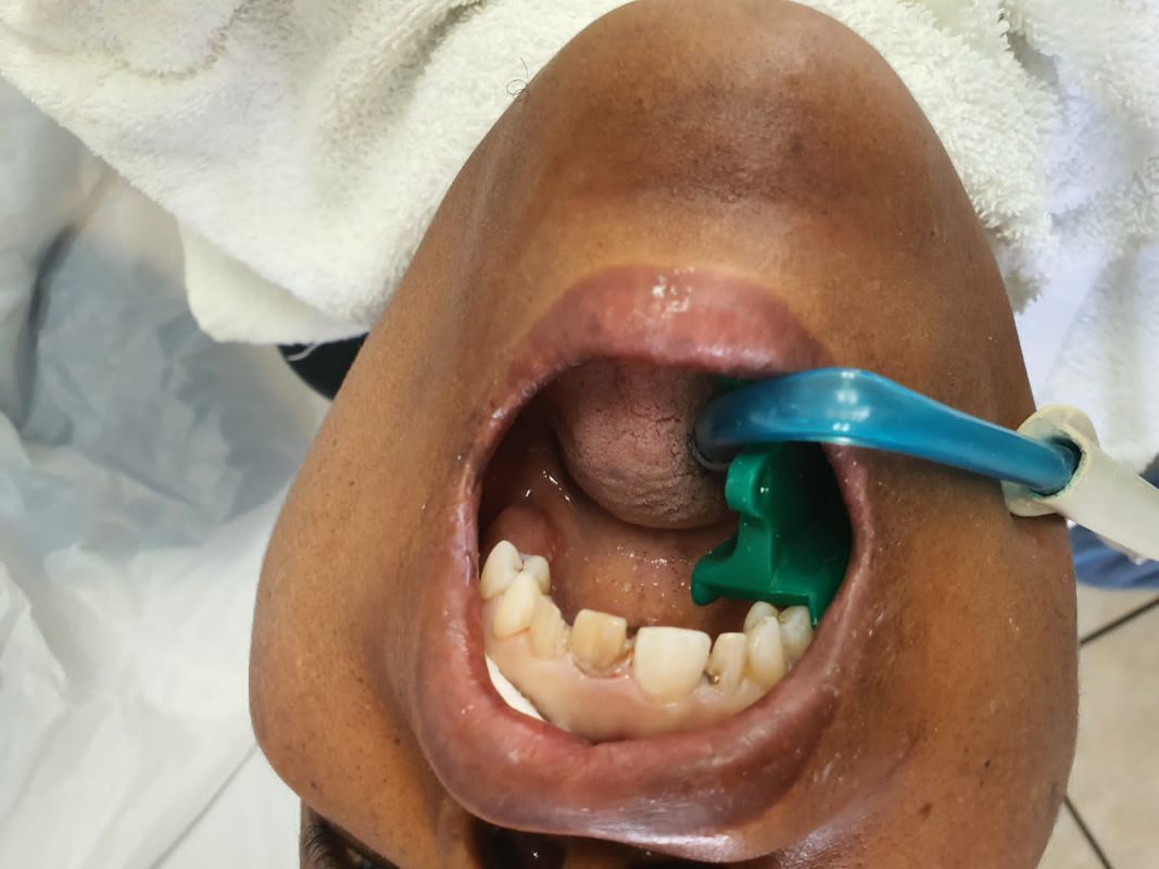 pain-free dental technologies