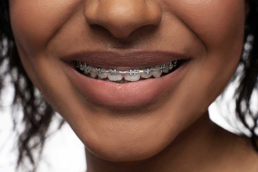 Braces