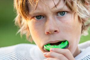Gum Guards